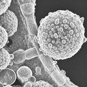 Microbes seen through an electron microscope